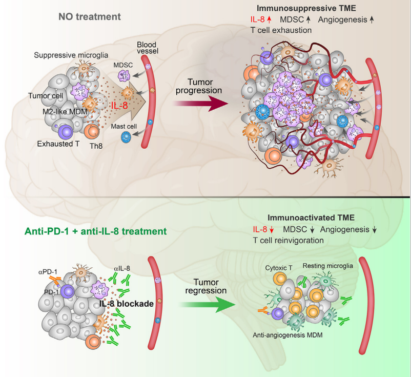 Tumor microenvironment regulator IL-8 Tumor microenvironment regulator IL-8